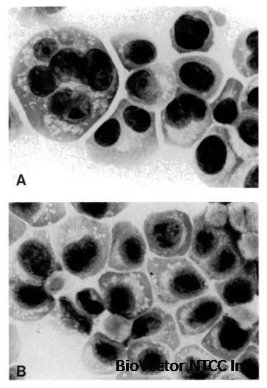 Establishment and Characterization of an Amylase-Producing Human Myeloma Cell  Line - ScienceDirect