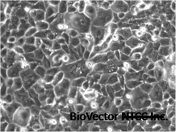 Establishment and characterization of a cell line (HCH-1) originating from  a human clear cell carcinoma of the ovary | Journal of Ovarian Research |  Full Text