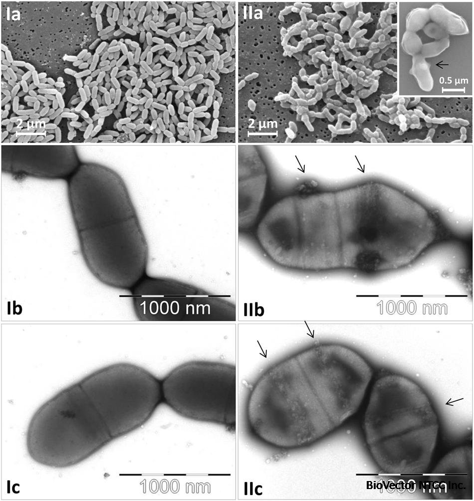 Frontiers | Quantification of Slackia and Eggerthella spp. in Human Feces  and Adhesion of Representatives Strains to Caco-2 Cells