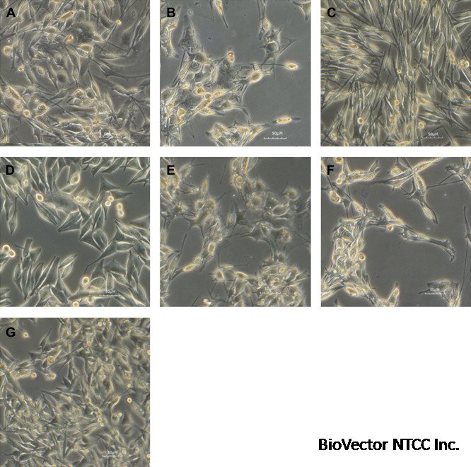 Establishment of novel cell lines recapitulating the genetic landscape of  uveal melanoma and preclinical validation of mTOR as a therapeutic target -  ScienceDirect