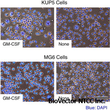 Establishment of c-myc-immortalized Kupffer cell line from a C57BL/6 mouse  strain - ScienceDirect