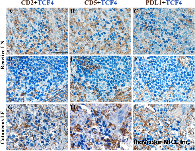 Plasmacytoid dendritic cells at the forefront of anti-cancer immunity:rewiring strategies for tumor microenvironment remodeling | Journal of  Experimental & Clinical Cancer Research | Full Text