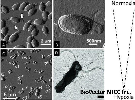 Clostridium novyi - an overview | ScienceDirect Topics