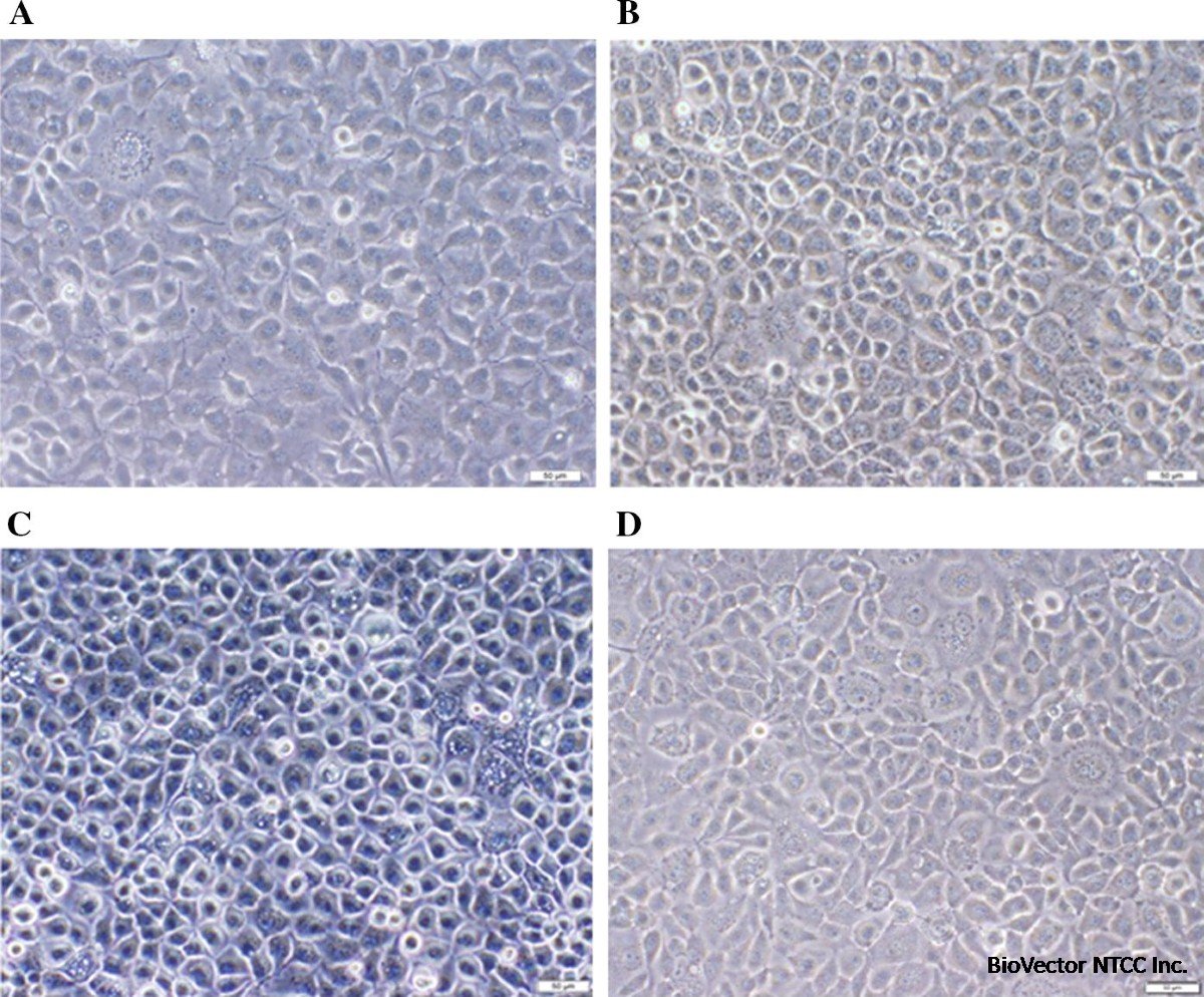 Development and biochemical and immunological characterization of early  passage and immortalized bovine intestinal epithelial cell lines from the  ileum of a young calf | Cytotechnology