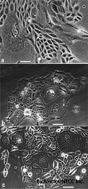 Establishment and Characterization of an Immortalized Human Sebaceous Gland Cell  Line (SZ95)1 - ScienceDirect