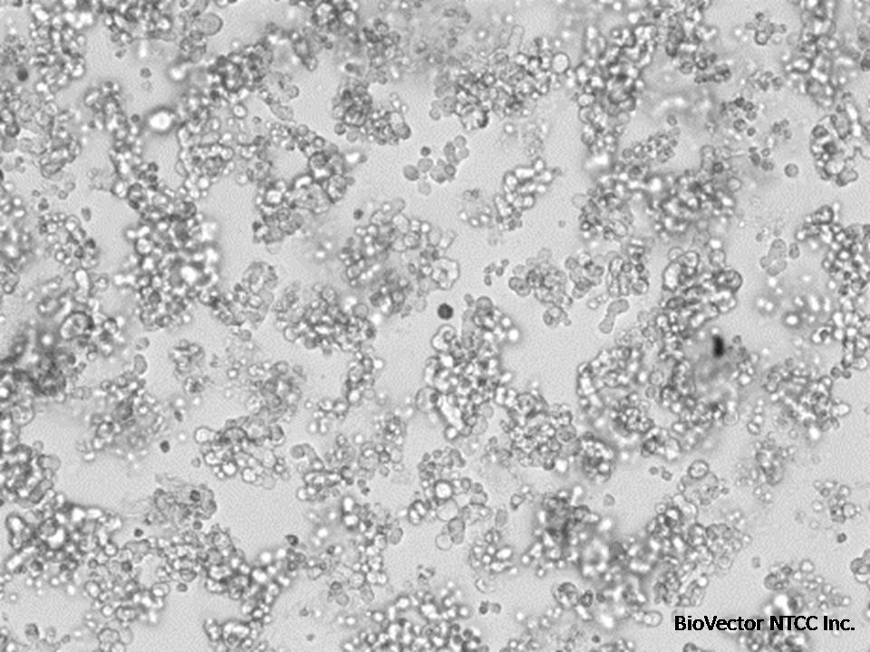 H69 - Human Small-Cell Lung Cancer cells - Viability 90 per cent.jpg