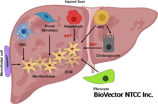 Therapeutic potential of targeting regulatory mechanisms of hepatic stellate cell activation in liver fibrosis - ScienceDirect