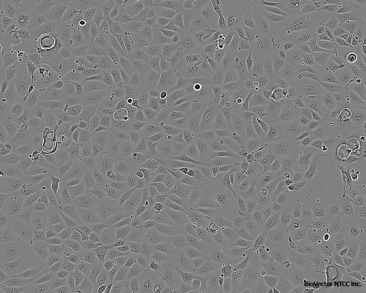 hEM15A Cell:人永生化子宫内膜异位症患者在位内膜间质细胞系价格 1123元/cells 厂家：上海宾穗生物科技有限公司