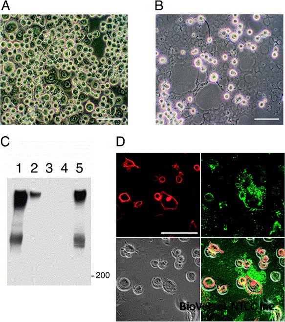 Establishment and characterization of a parietal endoderm-like cell line  derived from Engelbreth–Holm–Swarm tumor (EHSPEL), a possible resource for  an engineered basement membrane matrix - ScienceDirect