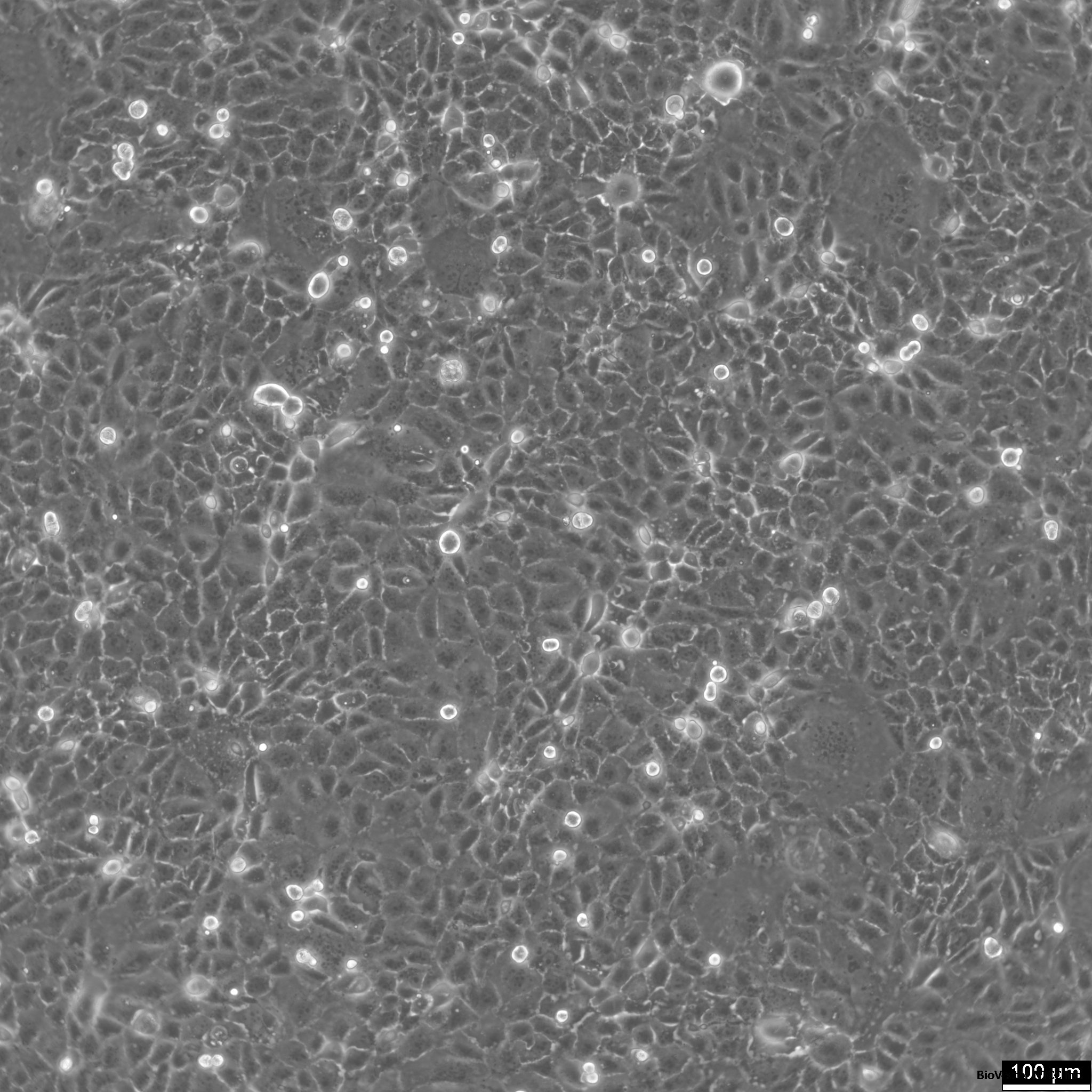 Human Intrahepatic cholangiocarcinoma cell line HuCC-T1