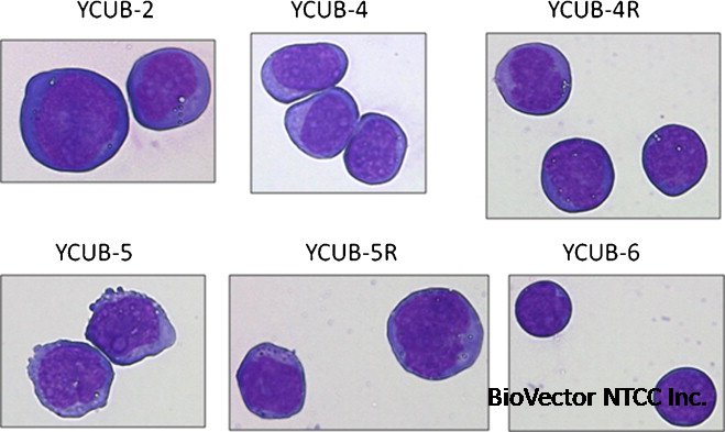 Chemo-sensitivity in a panel of B-cell precursor acute lymphoblastic  leukemia cell lines, YCUB series, derived from children - ScienceDirect