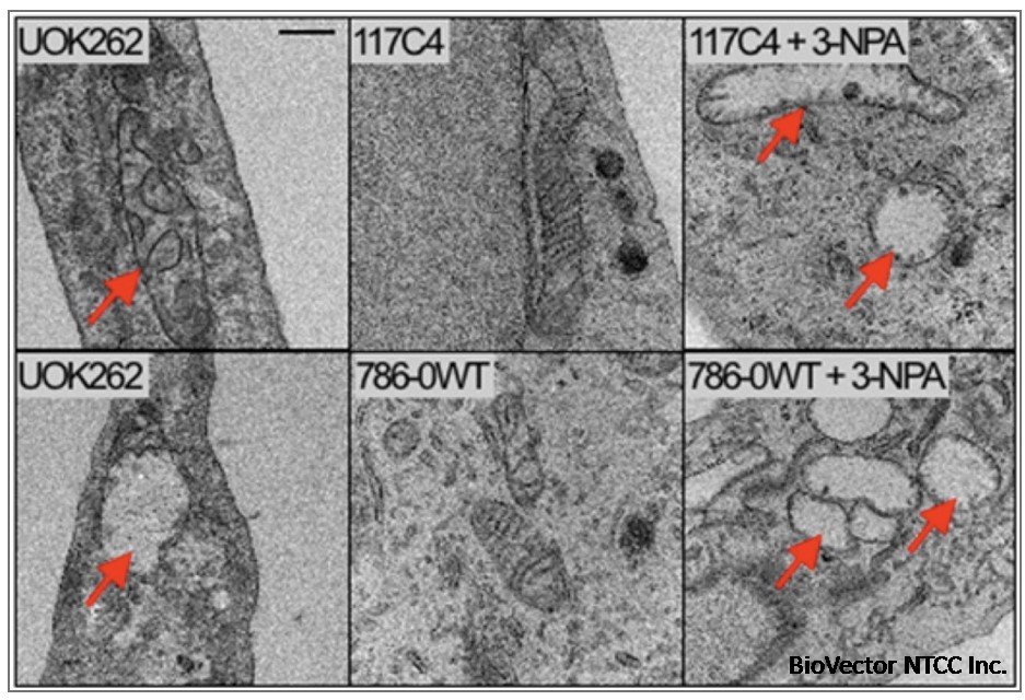 Submolecular Dysregulation Due to Deuterium Accumulation Is the Cause of  Cancer - Townsend Letter
