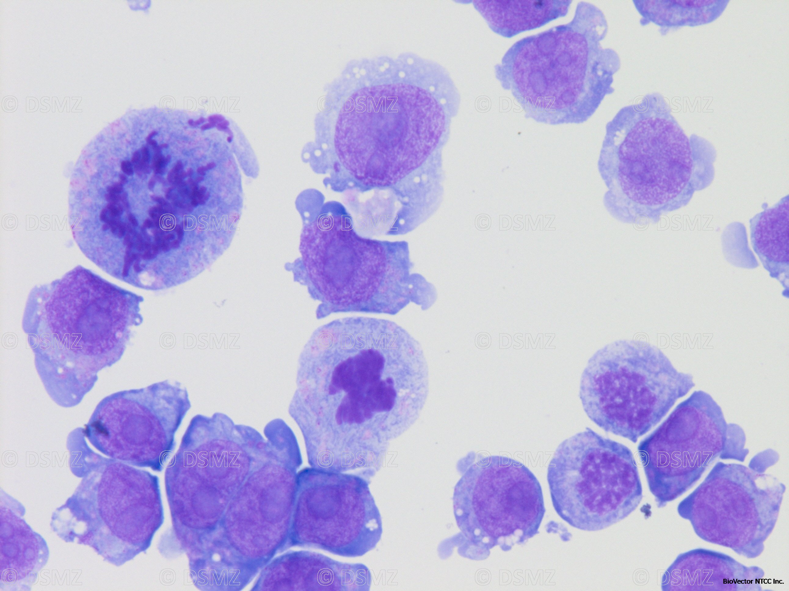 German Collection of Microorganisms and Cell Cultures GmbH:Welcome to the  Leibniz Institute DSMZ | PLB-985 (subclone of HL-60)