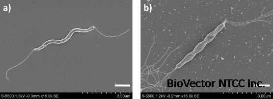 Clinical and bacteriological characteristics of Helicobacter cinaedi  infection - ScienceDirect