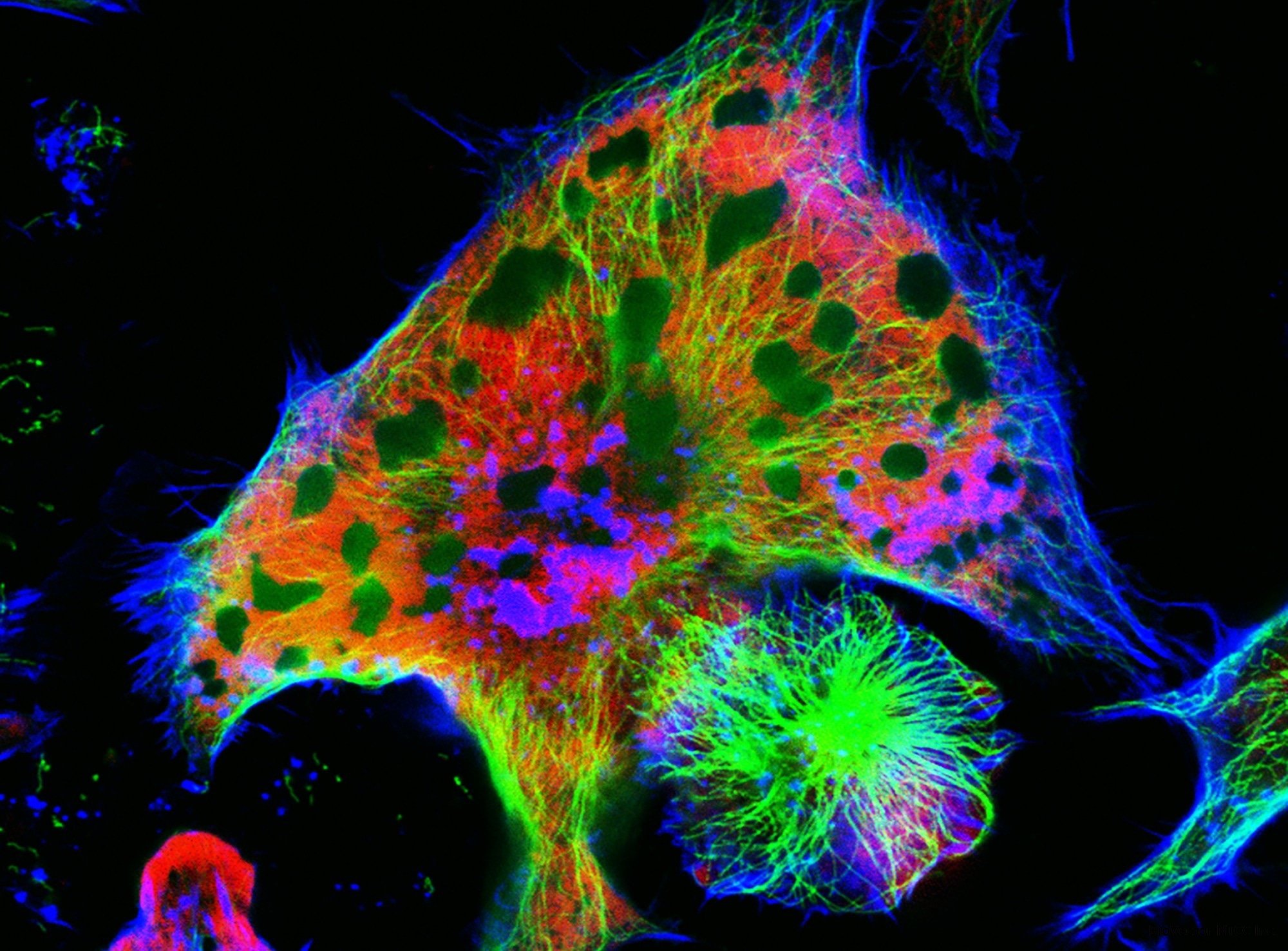 What is Neuroblastoma?
