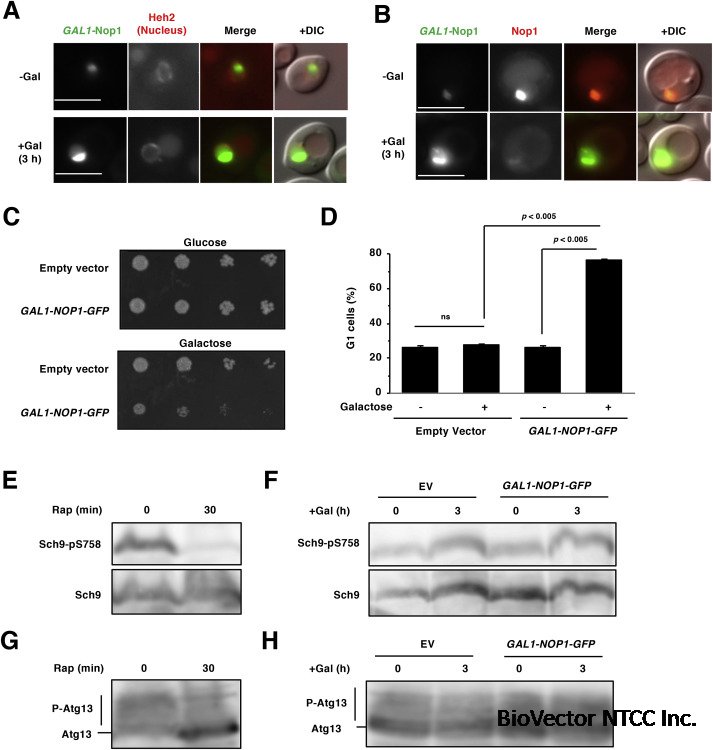 Def1 mediates the degradation of excess nucleolar protein Nop1 in budding  yeast - ScienceDirect
